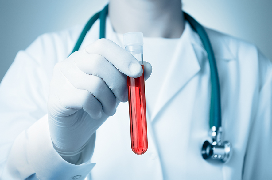 OPERATIVO IL NUOVO PUNTO PRELIEVI